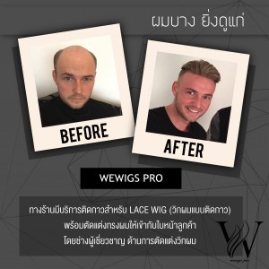 lacewig วิกติดกาว แก้-01
